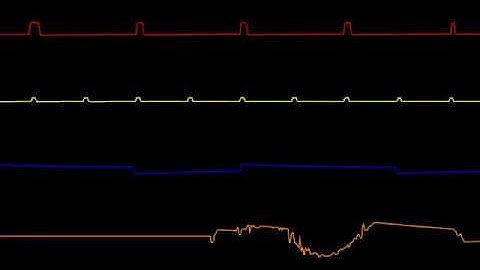 COMMODORE C64 SID - THE FINAL COUNTDOWN - 1988 - NIZZE (Oscilloscope View)