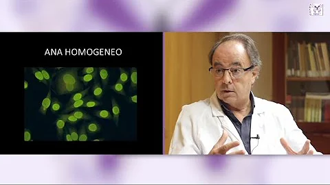 ¿Por qué se diagnostica mal el lupus?