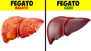 Quale alimento toglie la fame?