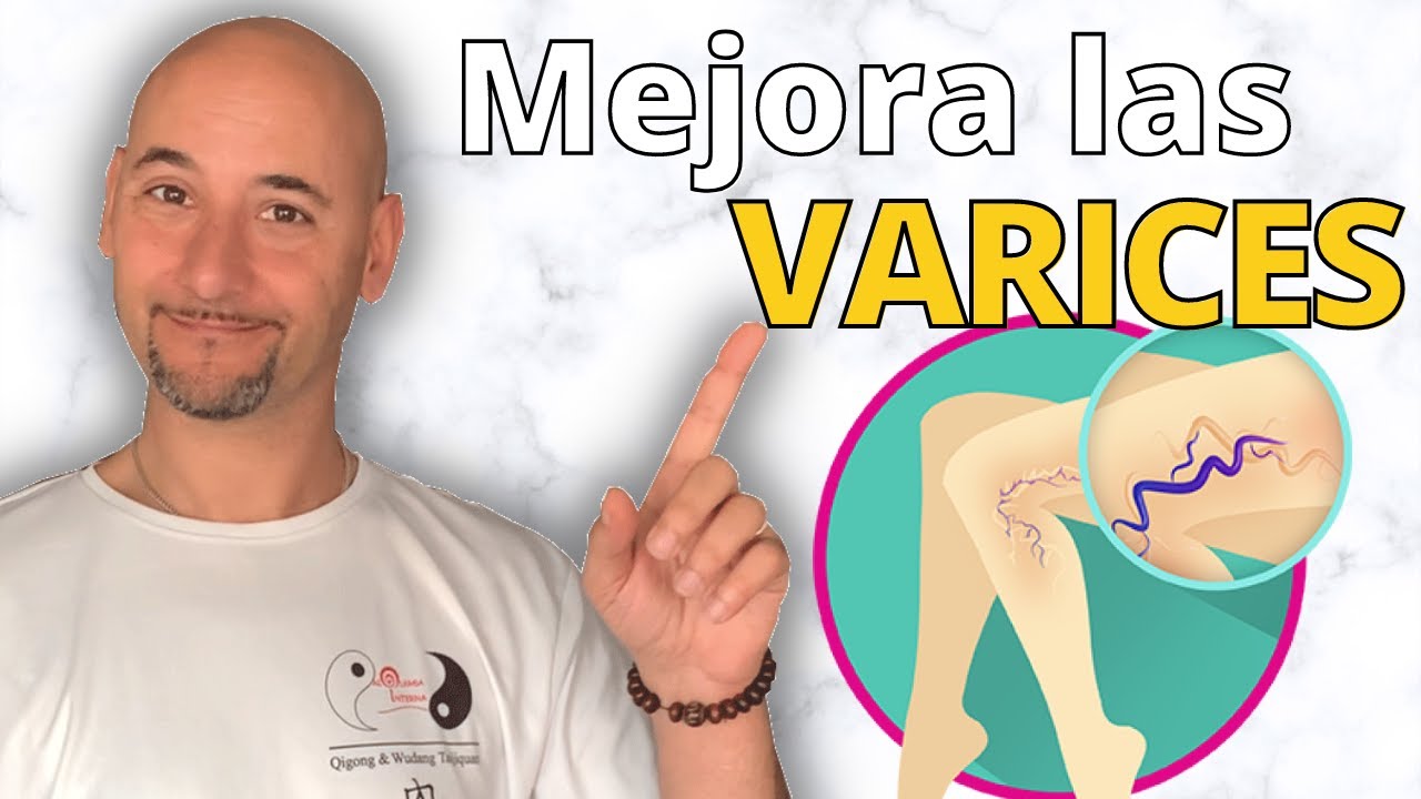 Moverte Así MEJORARÁ las VARICES y la CIRCULACIÓN