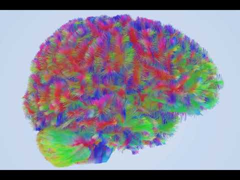 Розвиток мозку: чотири основні зміни від народження до 90 років