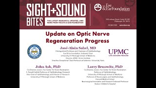 Sight + Sound Bites: Update on Optic Nerve Regeneration Progress