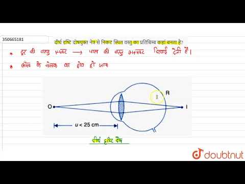 वीडियो: दीर्घ दृष्टि से पीड़ित आँख में प्रतिबिम्ब कहाँ बनता है?