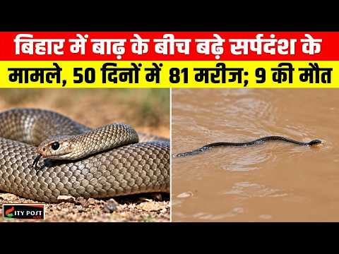 बिहार में बाढ़ के बीच बढ़े सर्पदंश के मामले, 50 दिनों में 81 मरीज; 9 की मौत ...