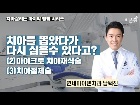 치아를 뽑았다가 <strong>다시</strong> 심을수 있다고? (2)<strong>마이크로</strong> 치아재식술, (3)치아절제술 / 연세마이덴치과 남택진