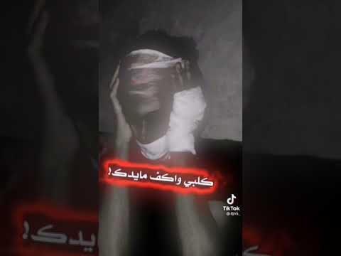 حالي حال المختنك كلبي واكف ما يدك