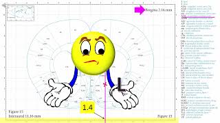 Determining coordinates in the rat brain
