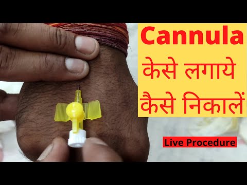 Cannula Kaise Lagate Hain | Kaise Nikale | Cannula Insertion Technique | Cannula Types | Hindi