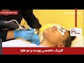لیزر موهای زائد فیلم لیزر موهای زائد کلینیک پوست و مو هلیا شماره 20 