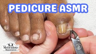 👣ASMR Pedicure Cleaning💆‍♀️How to Fix Big Toenails &amp; Pinky Nails Pedicure Tutorial👣