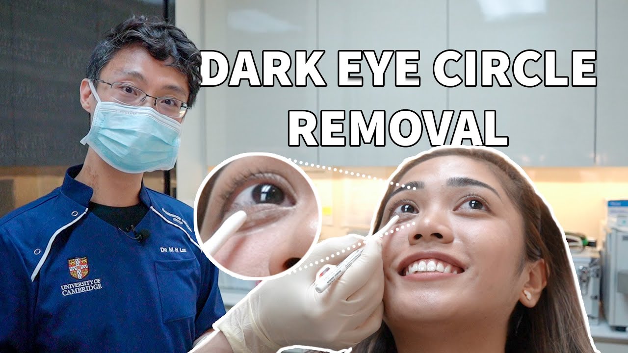 Rejuran I Treatment For Dark Eye Circles and Eyebags YouTube