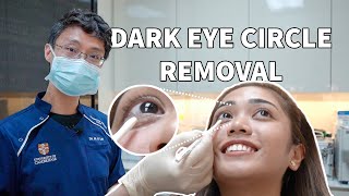 Rejuran I Treatment For Dark Eye Circles and Eyebags