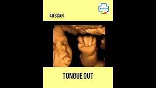 What is 3D and 4D Scan? | addon Scans and Labs | Ultrasound Scan | Dr. Sunil Kumar G.S