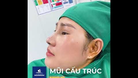 NÂNG MŨI CẤU TRÚC NANOFORM 6D ĐẸP HOÀN HẢO TẠI BÁC SĨ CHUYÊN NÂNG MŨI PHÙNG MẠNH CƯỜNG