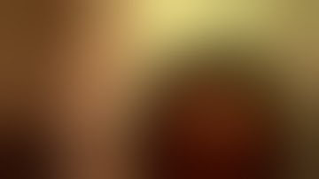 Restor SV25T0 exchange ( 3mm rhexis opening) by Steven G. Safran MD