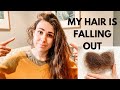 My Hair Is Falling Out // Acute Telogen Effluvium // Personal Update // Female Hair Loss