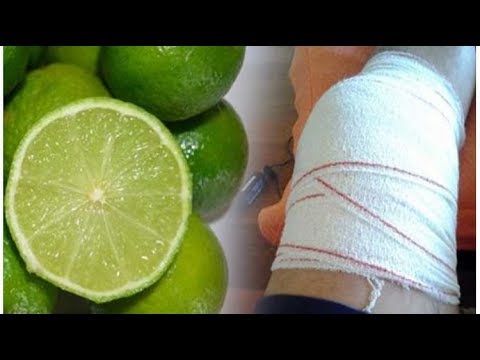 remedios naturales para la artritis Mezcla limón con este ingrediente y ponlo en tu rodilla, no tendrás dolores en un largo tiempo