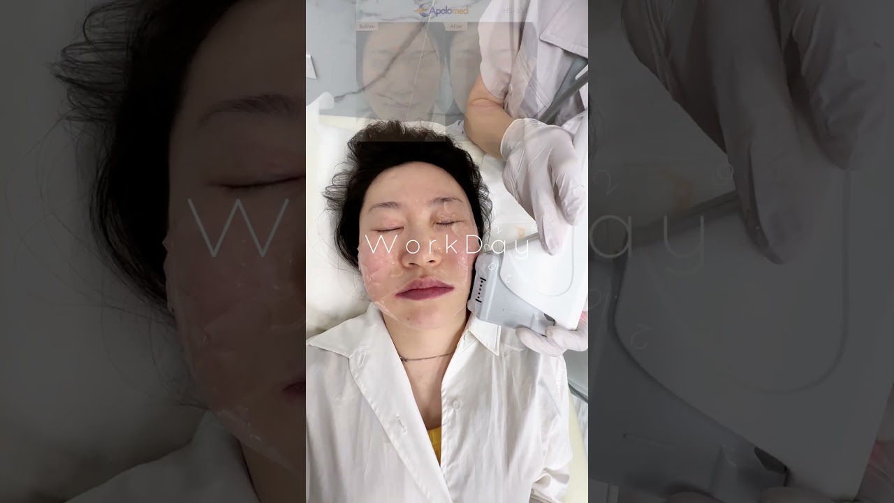 Precise stratified anti-aging for different skin depths; Non-invasive safety, collagen regeneration