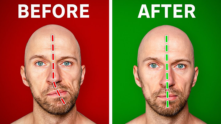 Fix Asymmetrical Jaw & Face (In Under 1 Minute a Day)