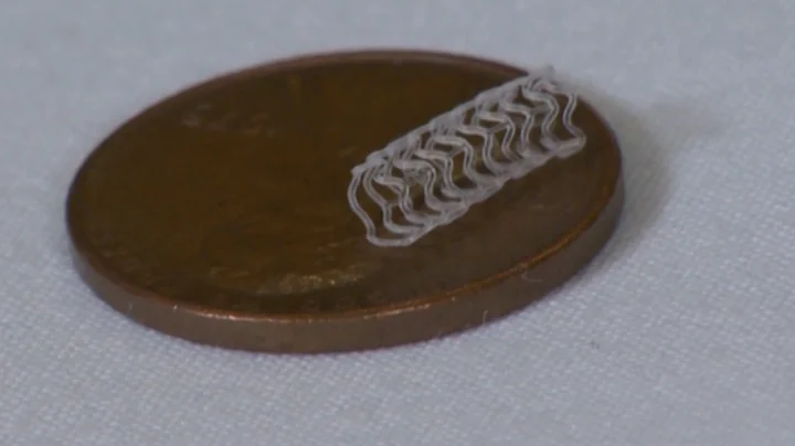 Innovation: Dissolvable Heart Stents