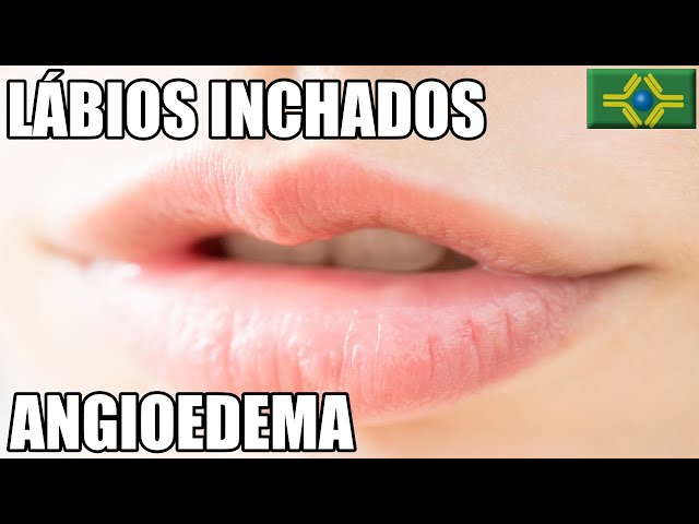 Labios Inchado Inchacos Normais Dos Pequenos Labios Vulva Disciplina Biologia