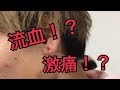 [閲覧注意]友達にノリでピアスを開けた。ピアスの痛み教えます。