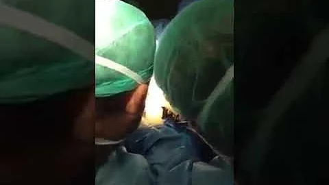 Viral Video Di Masukin Botol Dalam Kemaluan Nya