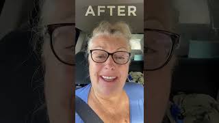 Megan took this video after she left New Teeth Now on the day of surgery. What amazing results.