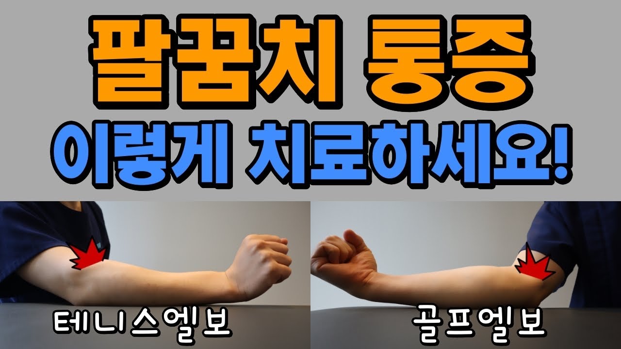 스스로 치료하는 테니스엘보&골프엘보 (팔꿈치통증- 외측상과염, 내측상과염) - Youtube