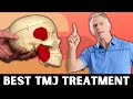 Absolute best tmj treatment you can do yourself for quick relief