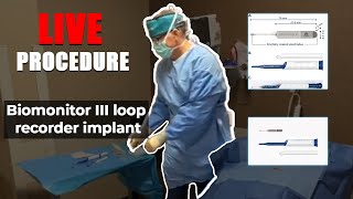 Implanting a Biotronik Biomonitor III loop recorder — watch the procedure!