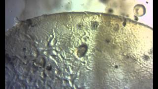 'Bagging' Process in C. elegans