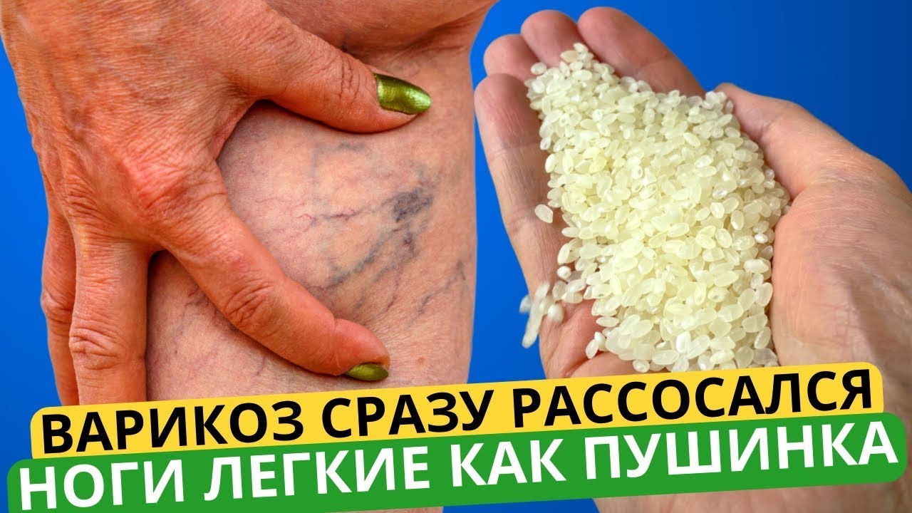 Китайский Убийца Варикоза: 7 Дней и ВАРИКОЗ РАССОСАЛСЯ, БЕРЕМ 1 ЛОЖКУ НА СТАКАН ВОДЫ!