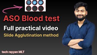 ASO Blood Test Practical | Step-by-Step Lab Procedure Explained in Hindi||#labtechnician #aso