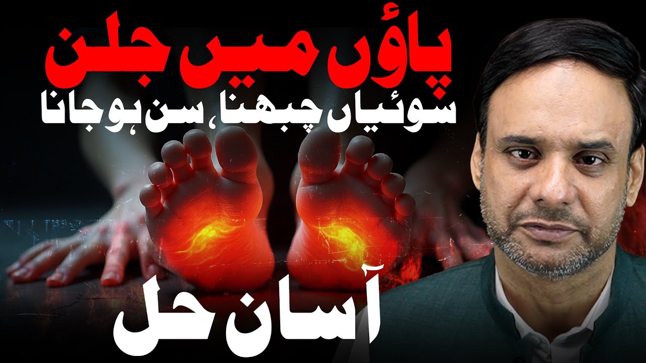 Treat Burning Feet & Hands | Diabetic Neuropathy Cure at Home | Guru Zahid | Channel Diabetes