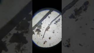 £95 Amazon microscope, big hairy  heterotardigrada and eutardigrada tardigrade, rotifers and casting