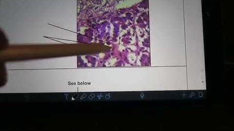 Week 1 Lab Video - Endocrine System