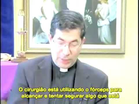 Pe. Frank Pavone - Como  um aborto.flv