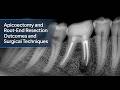 Apicoectomy Explained: Surprising Facts About Root-End Surgery in Dentistry