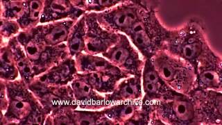 BGMK Cells Spreading as a Sheet by David Barlow 2,814 views 9 years ago 47 seconds