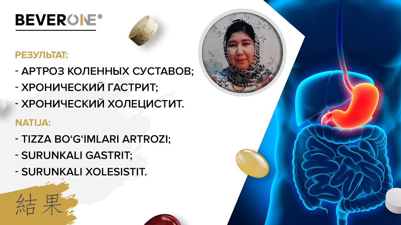 Артроз коленных суставов, хронический гастрит, хронический холецистит ...