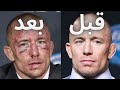 شاهد قصة النزال الذي غي ر ملامح الأسطورة جورج سانت بيير وجعله يفقد الذاكرة ودفعه إلى الإعتزال 