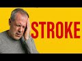 Stroke Hits Suddenly – Don’t Miss These Signs