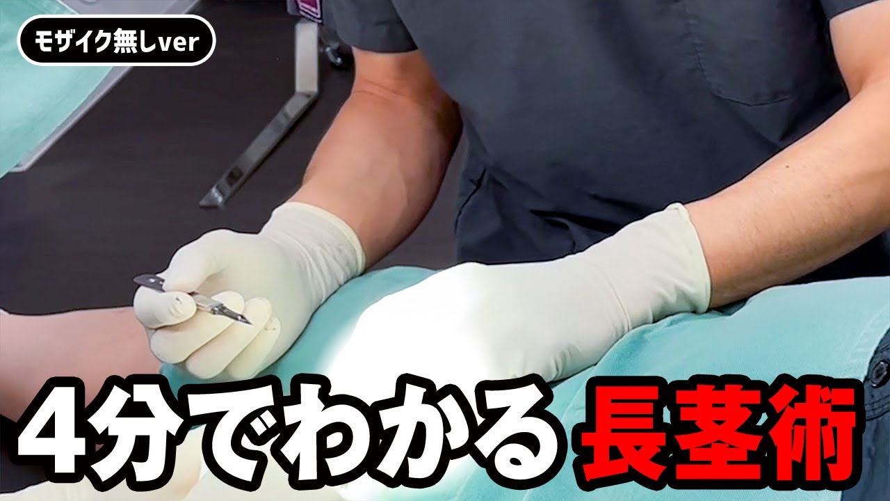 【4分でわかる！】長茎術の流れ【モザイク無し ビフォーアフター】 - YouTube