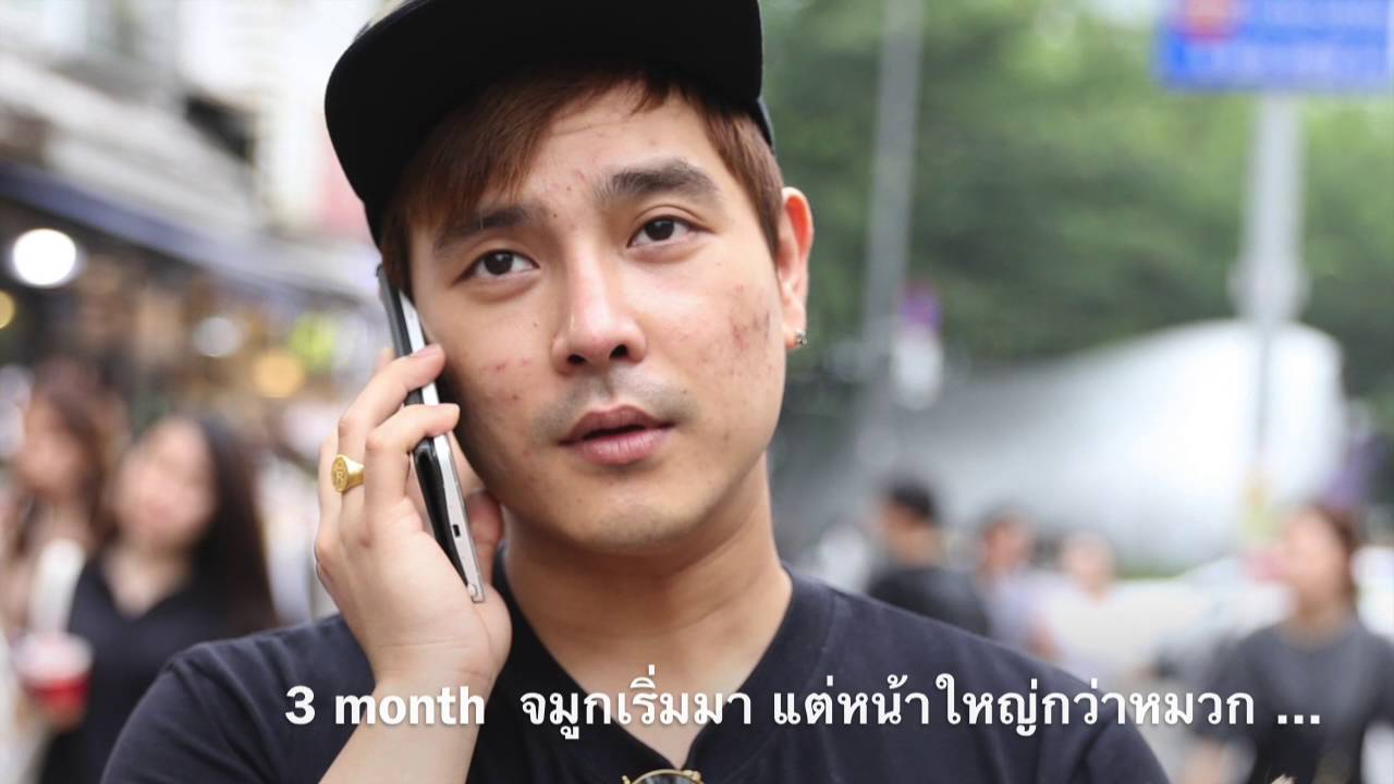 Korean Plastic Surgery ศัลยกรรมเกาหลี เสริมจมูก ตัดโหนกแก้ม วีไลน์ etc