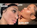 HOW I CLEARED MY ACNE FOR GOOD IN ONE WEEK (NO ACCUTANE) + SKINCARE GIVEAWAY | SKINCARE ROUTINE 2020