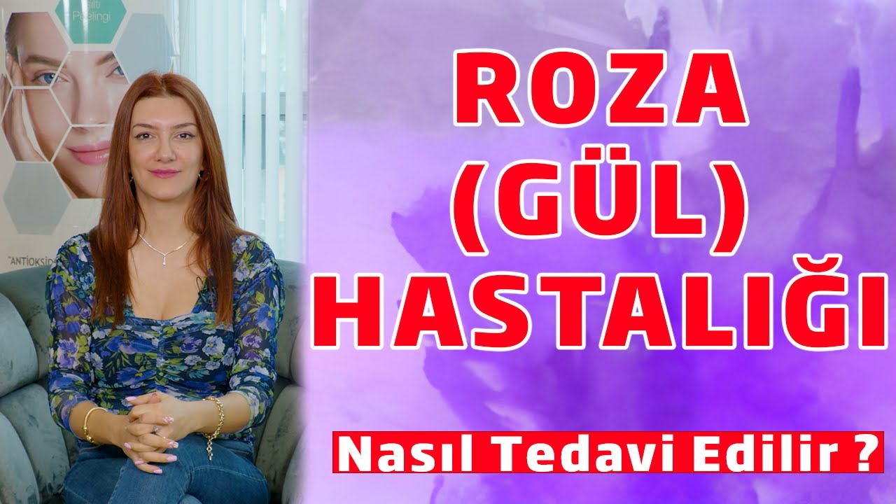 Roza (Gül) Hastalığı Nasıl Tedavi Edilir ?