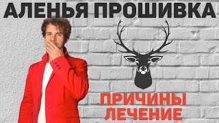 картинка: Что такое аленизм и лечение. Откуда берется оленья прошивка.