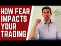 5 things you need to know before trading