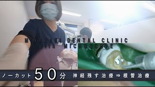 ”歯の神経を残す治療”の３カ月後に歯髄壊死　根管治療となった症例